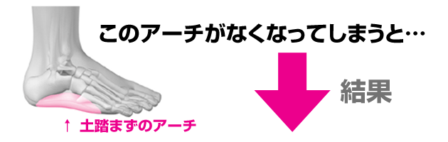 イラスト「土踏まずのアーチ」